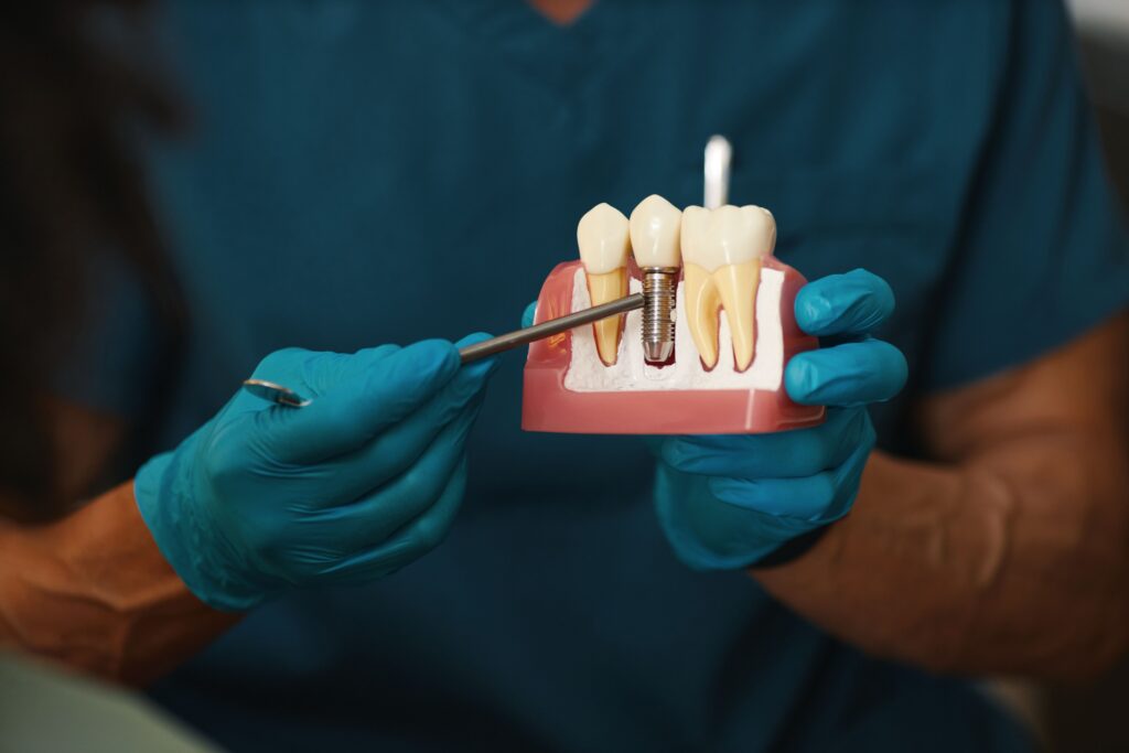 Smilestry Dental Wellness | Dental Implants