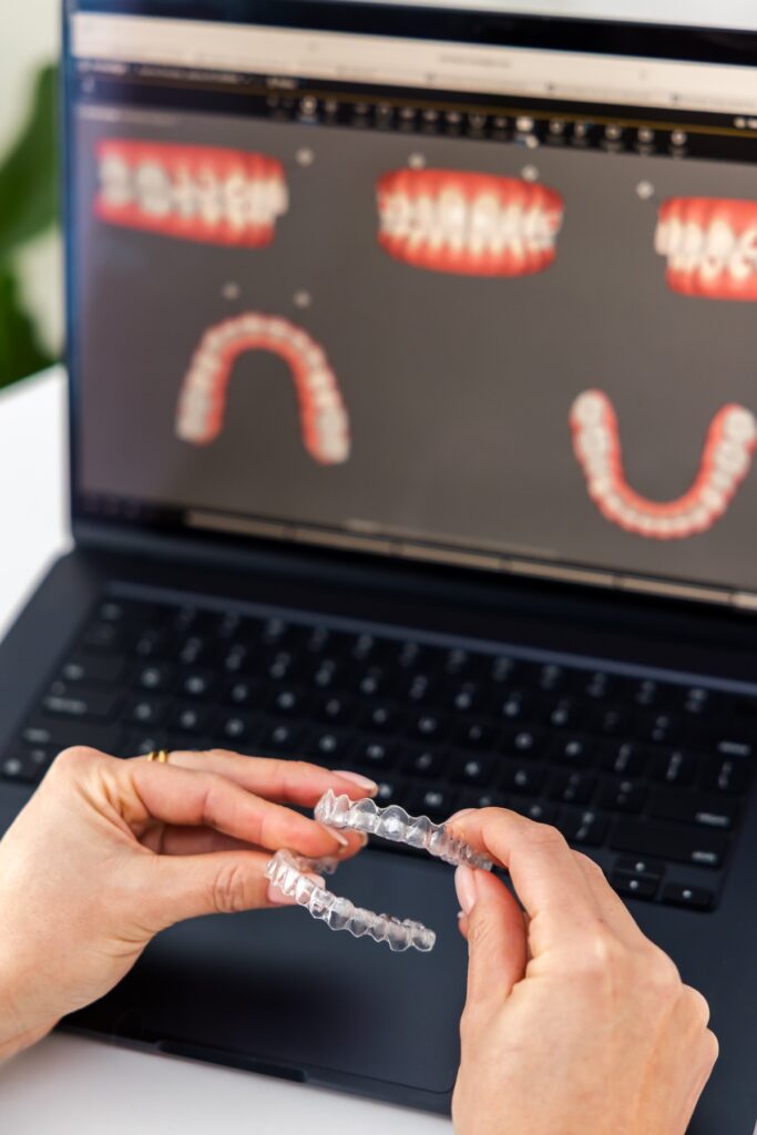 Smilestry Dental Wellness | Invisalign